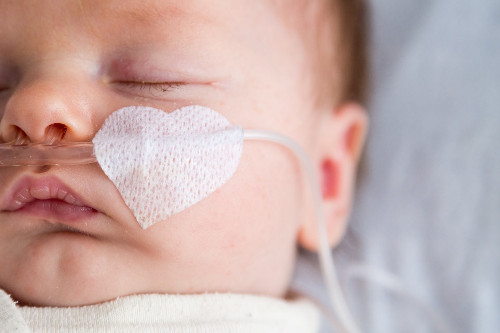 A baby with a oxygen tube taped with a heart-shaped bandage. To keep the baby healthy, preventing healthcare associated infections is paramount.
